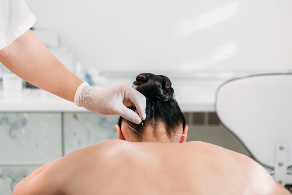 acupuncture for pain management calgary nw