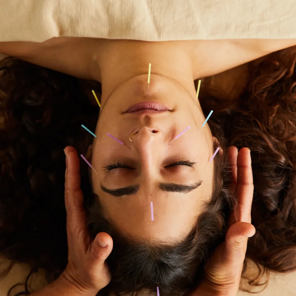 cosmetic acupuncture.jpg